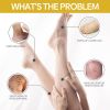 Ximonth Bee Venom Leg Care Cream s Leg Discomfort, Pamper And Moisturize Skin Care Cream