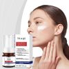 Hoygi Whitening And Freckle Removing Essence, Moisturizing Gentle Care For Skin Moisturizing Face Cream