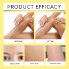 OUHOE Derma Care Bee Soap, Skin Moisturizing Skin Care Skin Cleansing Foam Soap