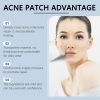 OUHOE Acne Patch Mild Clear Acne, Close Skin Facial Care Invisible Acne Patch